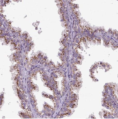 Msmp Antibody Ab185471  Immunohistochemistry Formalin Pfa Fixed Paraffin Embedded Sections Img111259