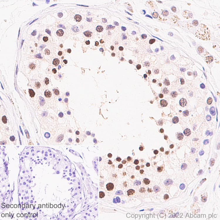 Anti-UBR7 antibody [EPR26170-67]