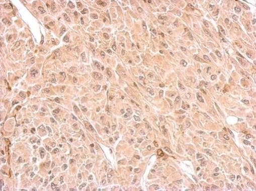 Anti-CNPase antibody(AB227218)