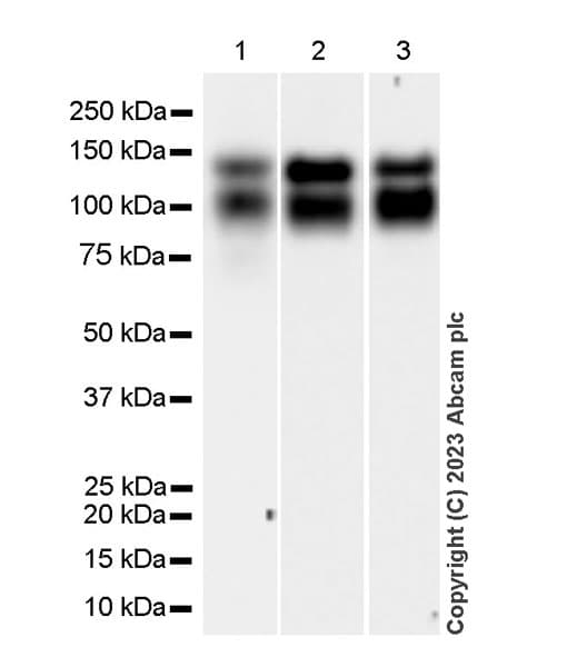 Trkc Antibody Epr22959 404 Ab313761  Western Blot Img418987
