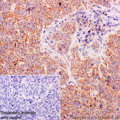 Anti-COX IV antibody [EPR9442(ABC)] - BSA and Azide free(AB231168)