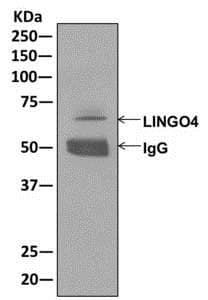 Anti-LINGO4 antibody [EPR12600](AB174832)
