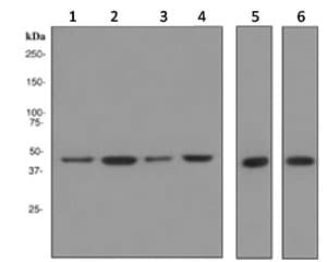 Nse Antibody Epr3378 Bsa And Azide Free Ab248462  Western Blot Img35126