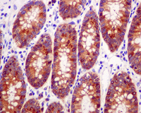 Anti-GARS antibody [EPR7157](AB125008)