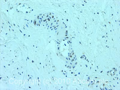 Anti-DDB2 antibody [2246C4a](AB51017)