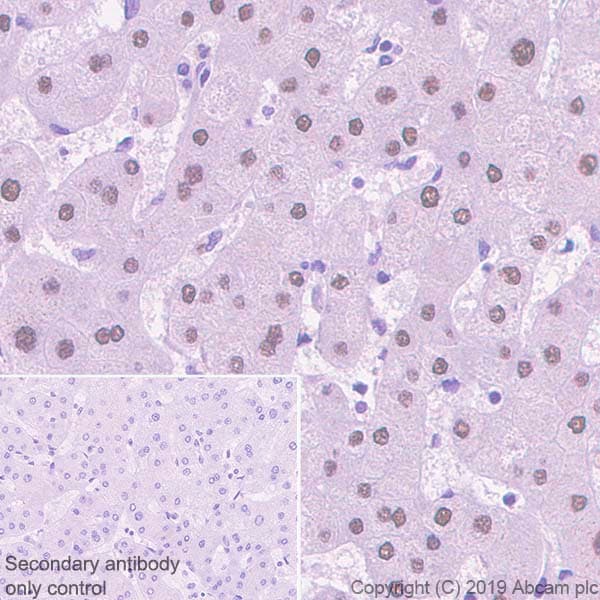 Hnf1 Alpha Antibody Epr23054 142 Ab242140  Immunohistochemistry Formalin Pfa Fixed Paraffin Embedded Sections Img117910