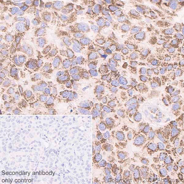 Anti-BMP4 antibody [EPR6211](AB124715)