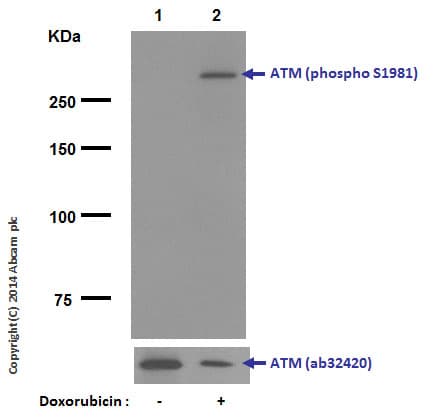 Anti-ATM (phospho S1981) antibody [EP1890Y](AB81292)