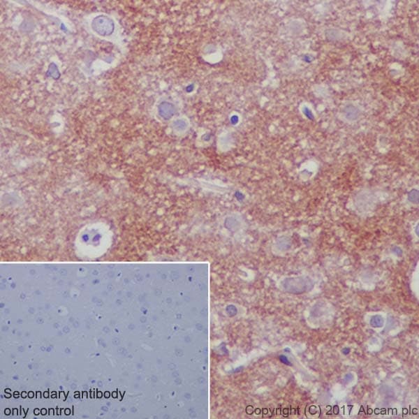 Ndufs4 Antibody Ep7832 Bsa And Azide Free Ab232337  Immunohistochemistry Formalin Pfa Fixed Paraffin Embedded Sections Img110898