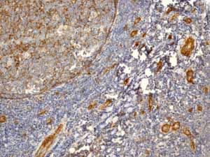 Anti-CD146 antibody [EPR3208](ab75769)