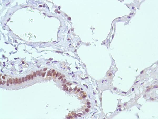 Anti-MSH2 antibody [SP46](AB231437)