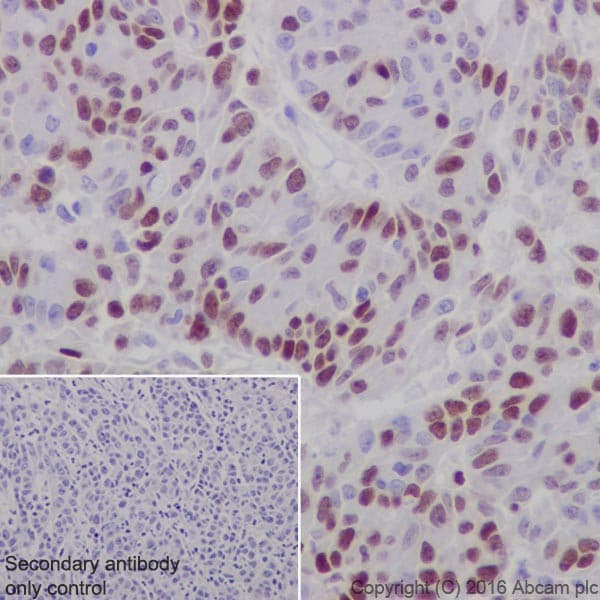 Uhrf1 Antibody Epr18803 11 Ab213223  Immunohistochemistry Formalin Pfa Fixed Paraffin Embedded Sections Img94617
