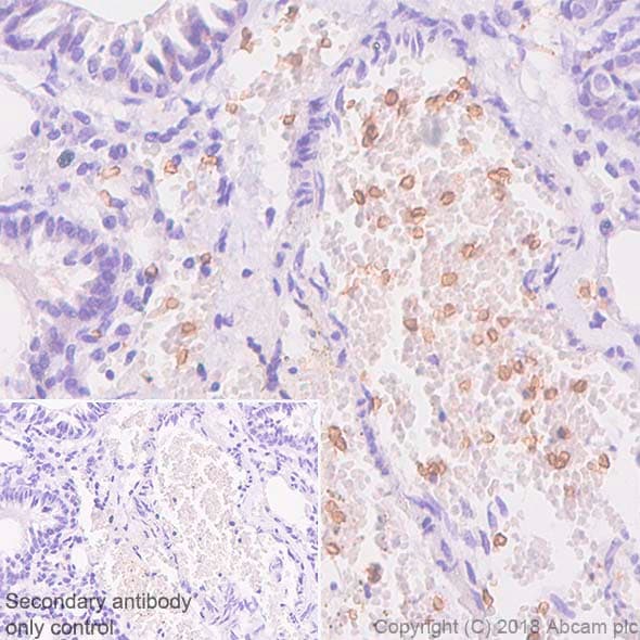 Anti-Glucose Transporter GLUT1 antibody [SP168](AB150299)