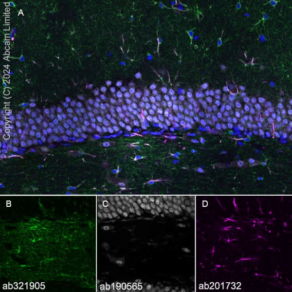 Alexa Fluor® 647 Anti-NeuN antibody [EPR12763] - Neuronal Marker(AB190565)