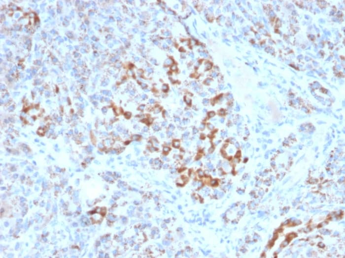 Frataxin Antibody Fxn 2124 Ab268063  Immunohistochemistry Formalin Pfa Fixed Paraffin Embedded Sections Img132918