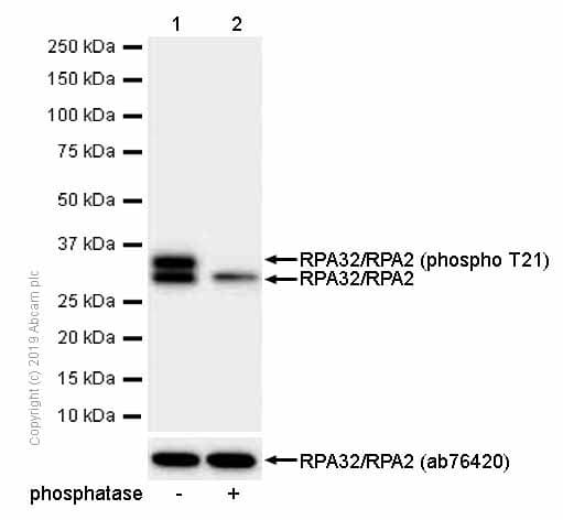 Anti-RPA32/RPA2 (phospho T21) antibody [EPR2846(2)](AB109394)