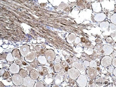 Anti-Alpha-synuclein aggregate antibody [MJFR-14-6-4-2] - BSA and Azide free(AB214033)