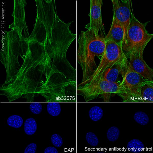 Anti-alpha smooth muscle Actin (acetyl E3) + ACTG2 (acetyl E3) antibody [E184](AB32575)