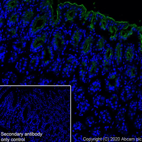 Anti-Mucin 5AC antibody [45M1](ab3649)