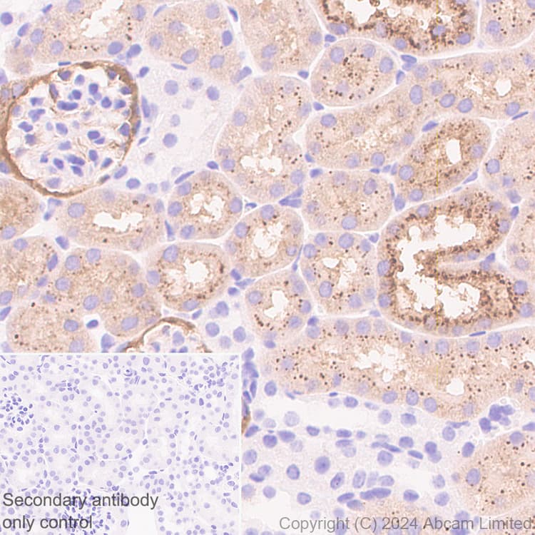 Anti-Cathepsin L/MEP antibody [EPR29413-573](AB321872)
