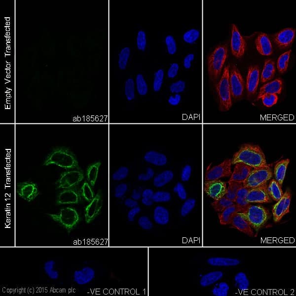 Anti-Keratin 12/K12 antibody [EPR17882] - BSA and Azide free(AB240295)