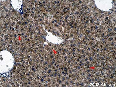 Rbp1 Antibody Ab104452  Immunohistochemistry Formalin Pfa Fixed Paraffin Embedded Sections Img115793