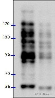 Anti-O-Linked N-Acetylglucosamine antibody [RL2](AB2739)