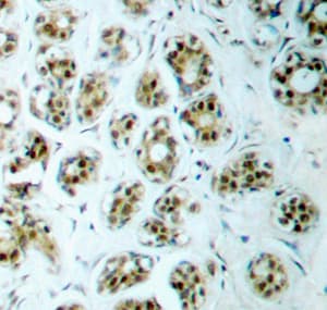 Nf Kb P65 Phospho S311 Antibody Ab194926  Immunohistochemistry Formalin Pfa Fixed Paraffin Embedded Sections Img63526