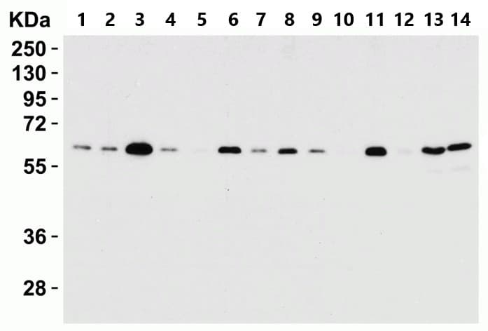 Anti-SQSTM1 / p62 antibody(AB91526)