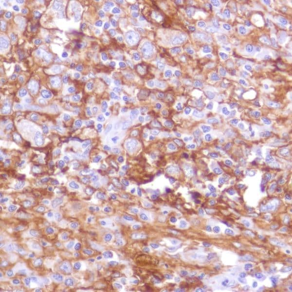Anti-PD-L1 antibody [SP142] - BSA and Azide free(ab236238)