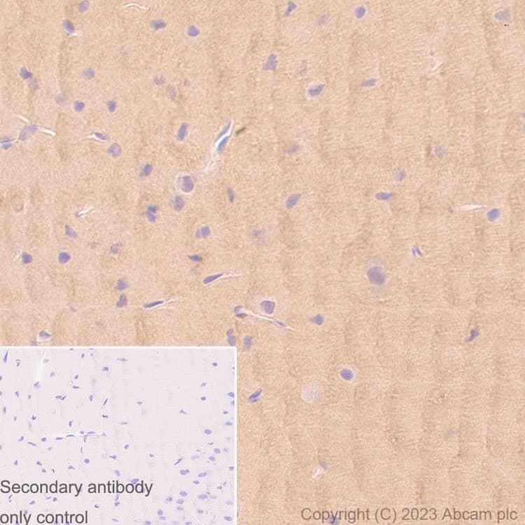 Pkm Antibody Epr10139 Ab154816  Immunohistochemistry Formalin Pfa Fixed Paraffin Embedded Sections Img417313