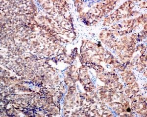 Scgn Secretagogin Antibody Epr7477 Bsa And Azide Free Ab248768  Immunohistochemistry Formalin Pfa Fixed Paraffin Embedded Sections Img66562