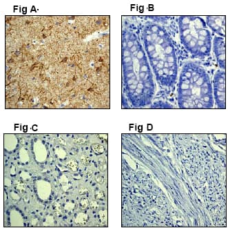 Alpha Internexin Antibody Ep676y Ab40758  Immunohistochemistry Formalin Pfa Fixed Paraffin Embedded Sections Img131288
