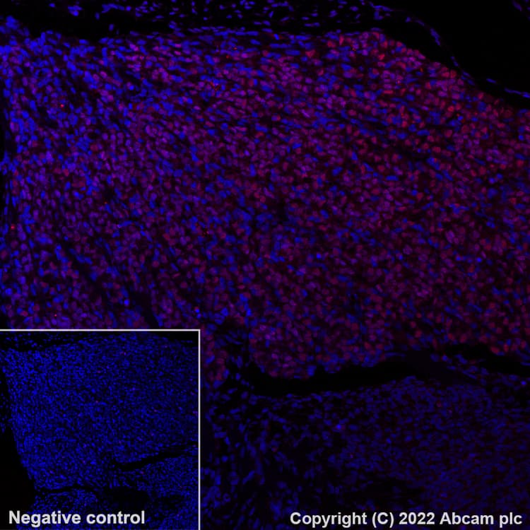 Alexa Fluor® 647 Anti-BRN3A antibody [EPR23257-285](AB300744)