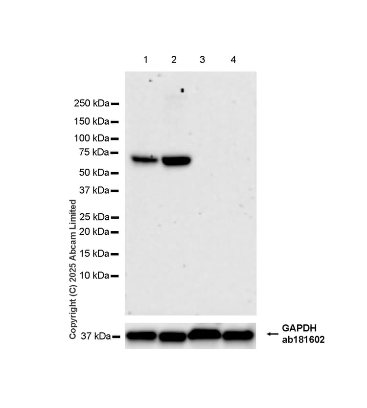 Anti-Estrogen Receptor alpha antibody [E115] - ChIP Grade(ab32063)