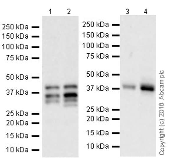 Anti-PITX2/RGS antibody [EPR22417](ab221142)