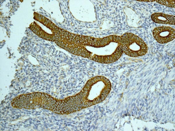 Cyp26a1 Antibody Epr11841 Ab172474  Immunohistochemistry Formalin Pfa Fixed Paraffin Embedded Sections Img135975