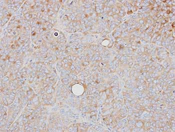 Prps1 Antibody Ab137577  Immunohistochemistry Formalin Pfa Fixed Paraffin Embedded Sections Img26511