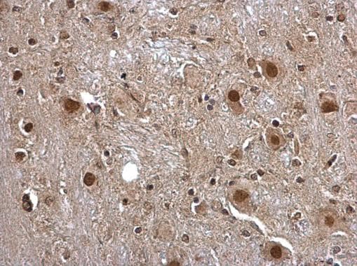 Anti-Pirin/PIR antibody(AB227280)