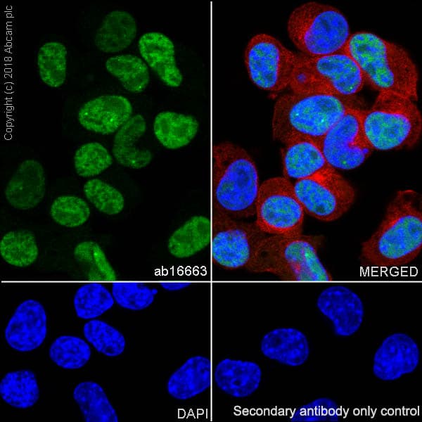Anti-Cyclin D1 antibody [SP4](AB16663)