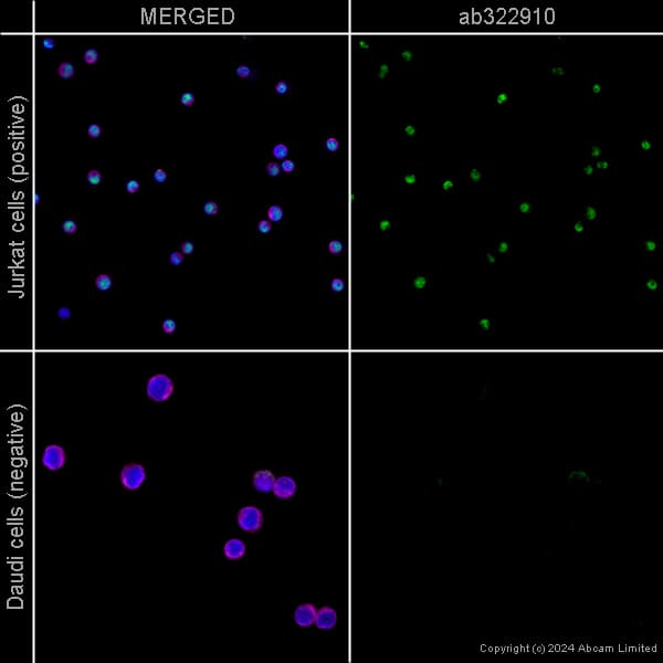 Alexa Fluor 594 Alpha Tubulin Antibody Ep1332y Microtubule Marker Ab202272  Immunocytochemistry Immunofluorescence Img440192