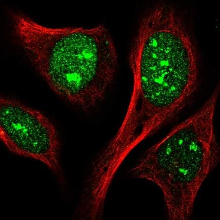 Anti-IPO11 antibody(AB221615)