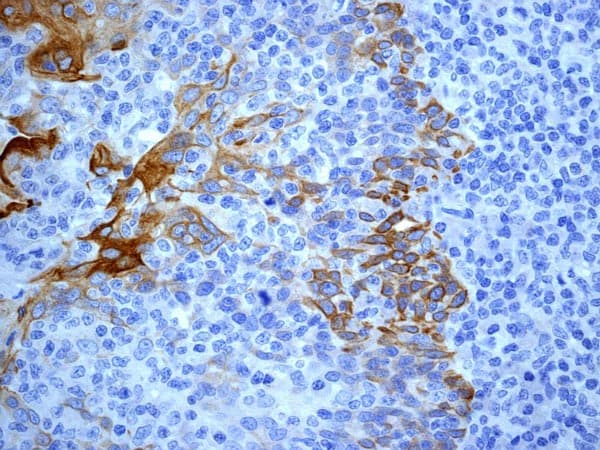 Cytokeratin 17 Antibody Ep1623 Bsa And Azide Free Ab239986  Immunohistochemistry Formalin Pfa Fixed Paraffin Embedded Sections Img121060