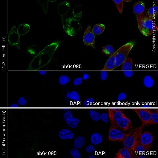 Anti-TMEM16A antibody [SP31](ab64085)