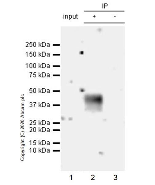 Anti-CCR2 antibody [EPR20844-15](AB273050)