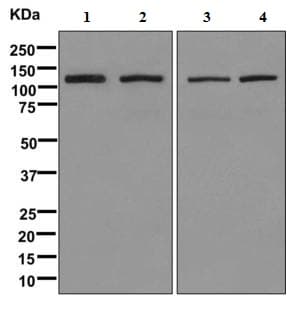 Bicd1 Antibody Epr11642 Bsa And Azide Free Ab249558  Western Blot Img116107