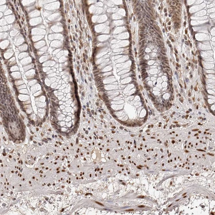 Znf503 Antibody Ab254715  Immunohistochemistry Formalin Pfa Fixed Paraffin Embedded Sections Img106765
