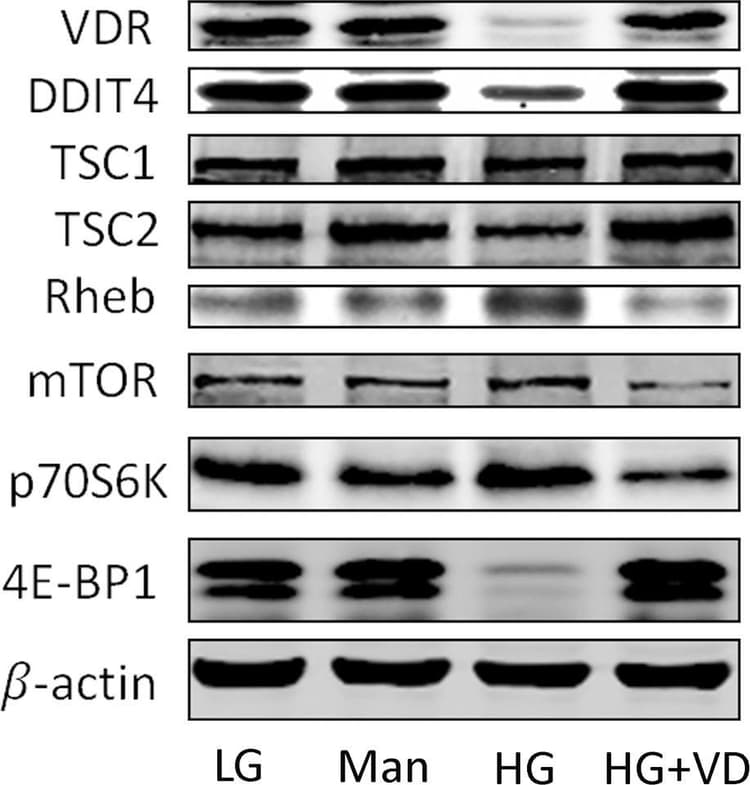 Anti-Vitamin D Receptor antibody [EPR4552] - ChIP Grade(AB109234)
