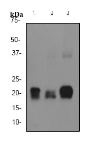 Anti-Ferritin heavy chain antibody [EPR3004Y](ab75973)