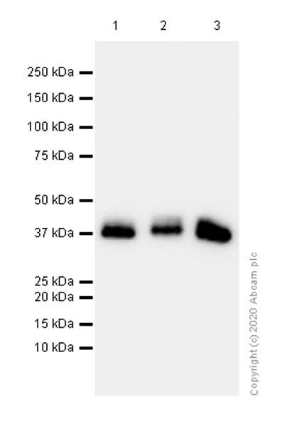 Anti-Aldolase B + Aldolase C antibody [EPR3138Y](ab75751)